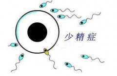 你知道精子为什么会少吗？